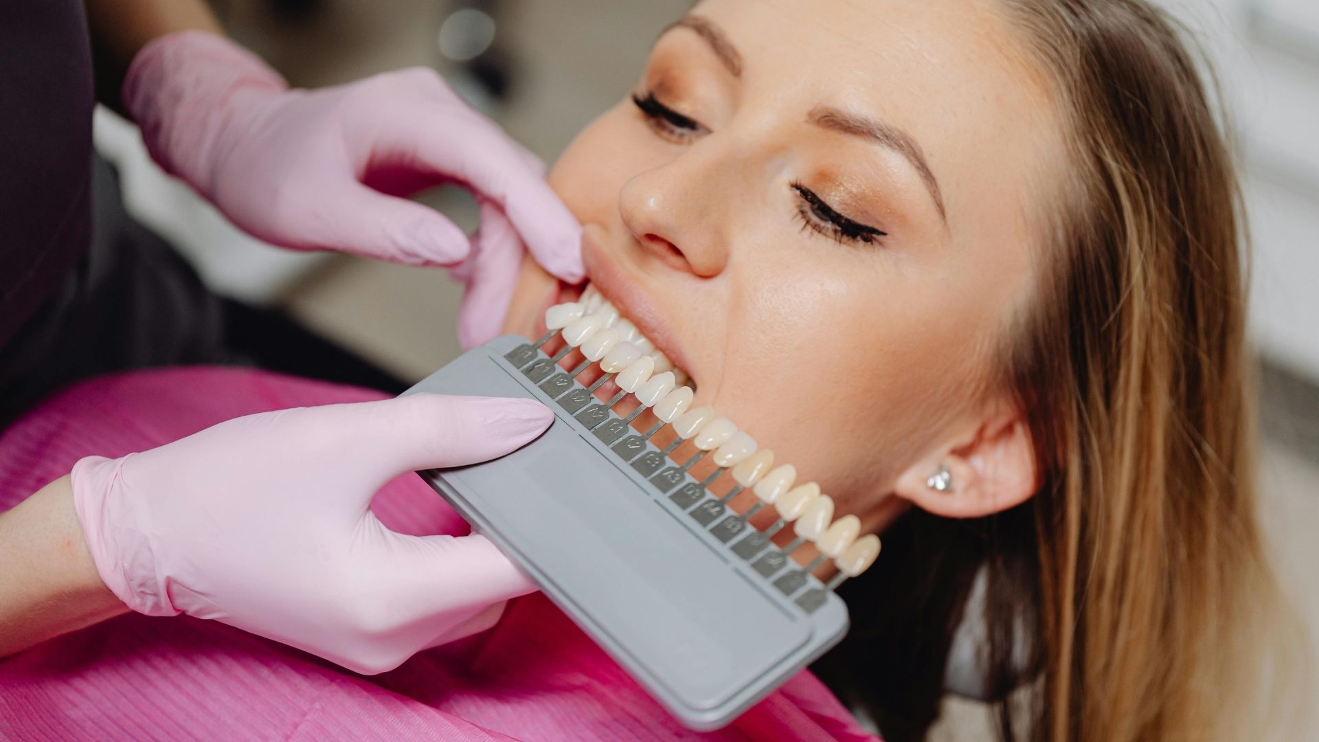 Paciente sorrindo apos clareamento dental